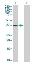 Western blot - Anti-USP46 antibody (AB88795)