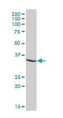 Western blot - Anti-USP46 antibody (AB88795)