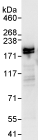 Immunoprecipitation - Anti-USP47 antibody (AB72143), expandable thumbnail