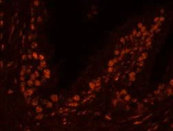 Immunohistochemistry (Formalin/PFA-fixed paraffin-embedded sections) - Anti-USP47 antibody (AB84531)