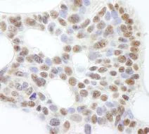 Immunohistochemistry (Formalin/PFA-fixed paraffin-embedded sections) - Anti-USP47 antibody (AB84531)