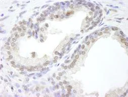 Immunohistochemistry (Formalin/PFA-fixed paraffin-embedded sections) - Anti-USP47 antibody (AB84531)