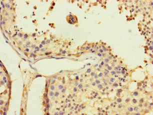 Immunohistochemistry (Formalin/PFA-fixed paraffin-embedded sections) - Anti-USP5 antibody (AB235772)