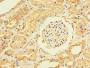 Immunohistochemistry (Formalin/PFA-fixed paraffin-embedded sections) - Anti-USP5 antibody (AB235772)