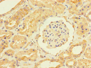Immunohistochemistry (Formalin/PFA-fixed paraffin-embedded sections) - Anti-USP5 antibody (AB235772)