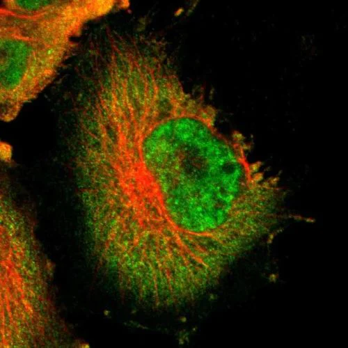 Immunocytochemistry/ Immunofluorescence - Anti-USP5 antibody (AB244290)