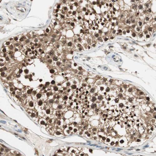 Immunohistochemistry (Formalin/PFA-fixed paraffin-embedded sections) - Anti-USP5 antibody (AB244290)