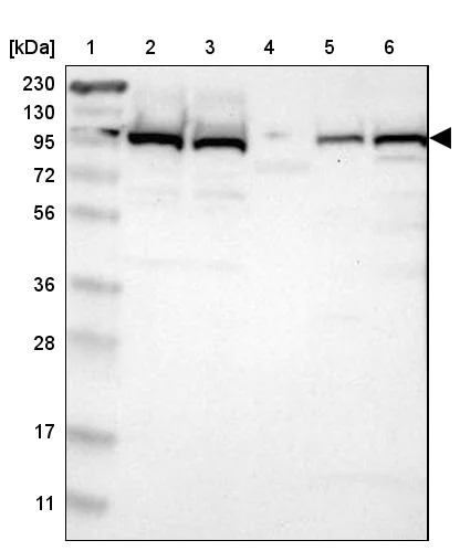Western blot - Anti-USP5 antibody (AB244290)
