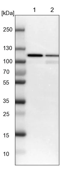 Western blot - Anti-USP5 antibody (AB244290)