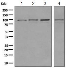 Western blot - Anti-USP5 antibody [EPR10453] (AB155993), expandable thumbnail