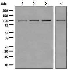 Western blot - Anti-USP5 antibody [EPR10453] (AB155993)