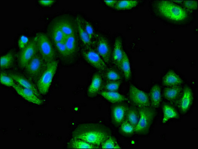 Immunocytochemistry/ Immunofluorescence - Anti-USP6 antibody (AB224725), expandable thumbnail
