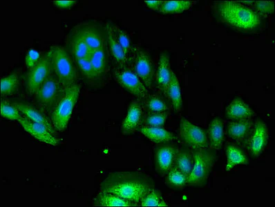 Immunocytochemistry/ Immunofluorescence - Anti-USP6 antibody (AB224725)