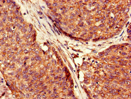 Immunohistochemistry (Formalin/PFA-fixed paraffin-embedded sections) - Anti-USP6 antibody (AB224725), expandable thumbnail