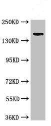 Western blot - Anti-USP6 antibody (AB224725), expandable thumbnail