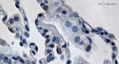Immunohistochemistry (Formalin/PFA-fixed paraffin-embedded sections) - Anti-Uteroglobin antibody (AB40873)