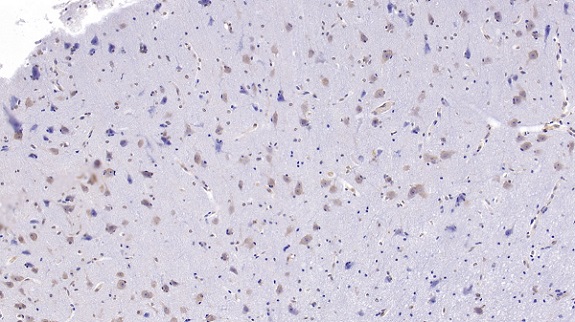 Immunohistochemistry (Formalin/PFA-fixed paraffin-embedded sections) - Anti-Uteroglobin antibody [C2] (AB239472), expandable thumbnail