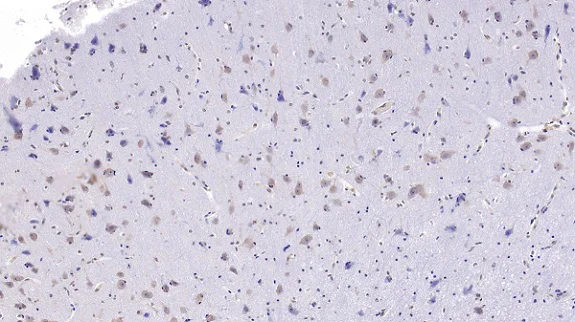 Immunohistochemistry (Formalin/PFA-fixed paraffin-embedded sections) - Anti-Uteroglobin antibody [C2] (AB239472)