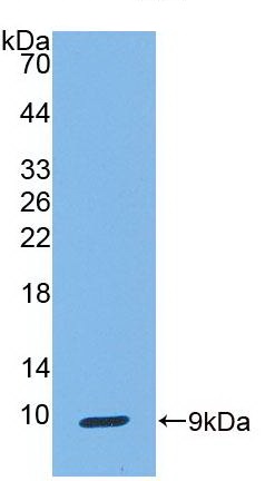 Western blot - Anti-Uteroglobin antibody [C2] (AB239472), expandable thumbnail