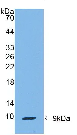 Western blot - Anti-Uteroglobin antibody [C2] (AB239472)