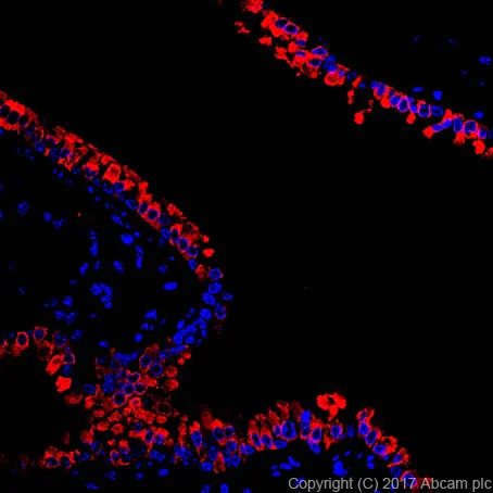 Immunohistochemistry (Formalin/PFA-fixed paraffin-embedded sections) - Anti-Uteroglobin antibody [EPR19846] (AB213203)