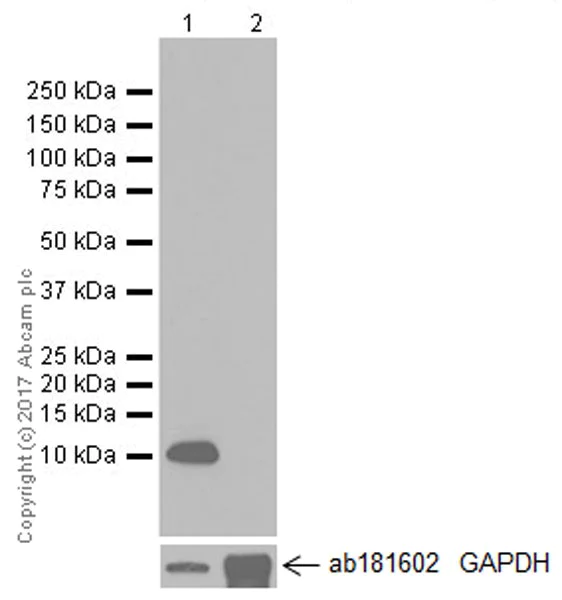 Western blot - Anti-Uteroglobin antibody [EPR19846] (AB213203)