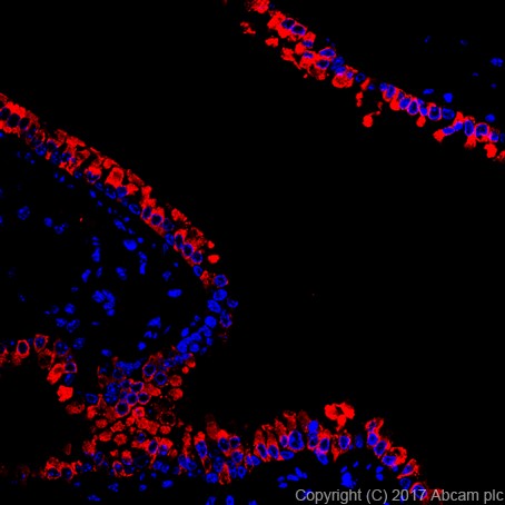 Anti-Uteroglobin antibody [EPR19846] - BSA and Azide free