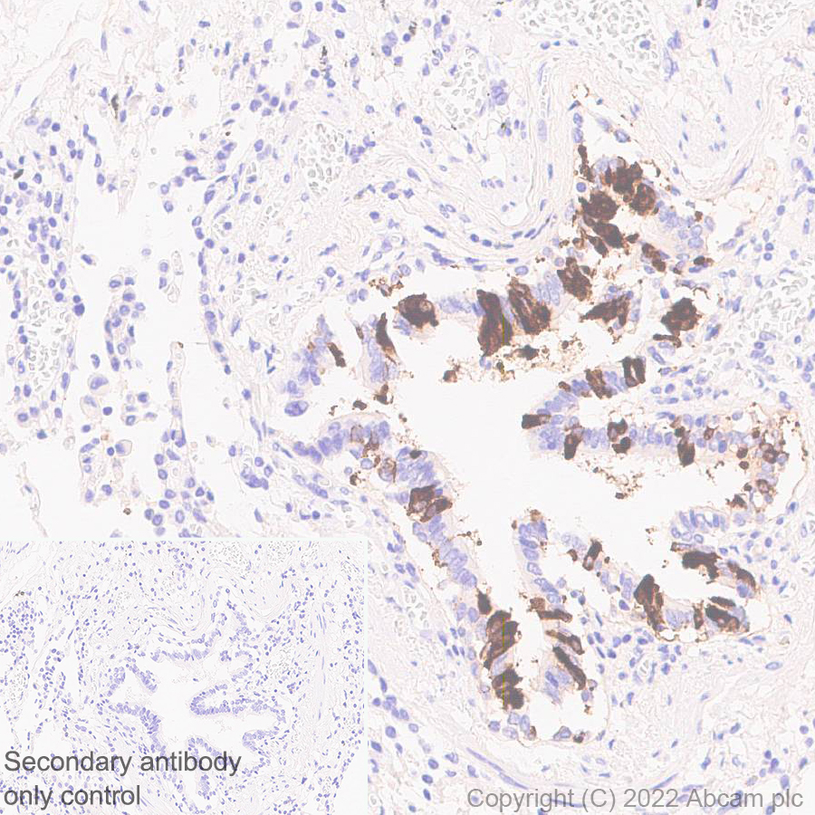 Immunohistochemistry (Formalin/PFA-fixed paraffin-embedded sections) - Anti-Uteroglobin antibody [EPR27144-86] (AB307666)