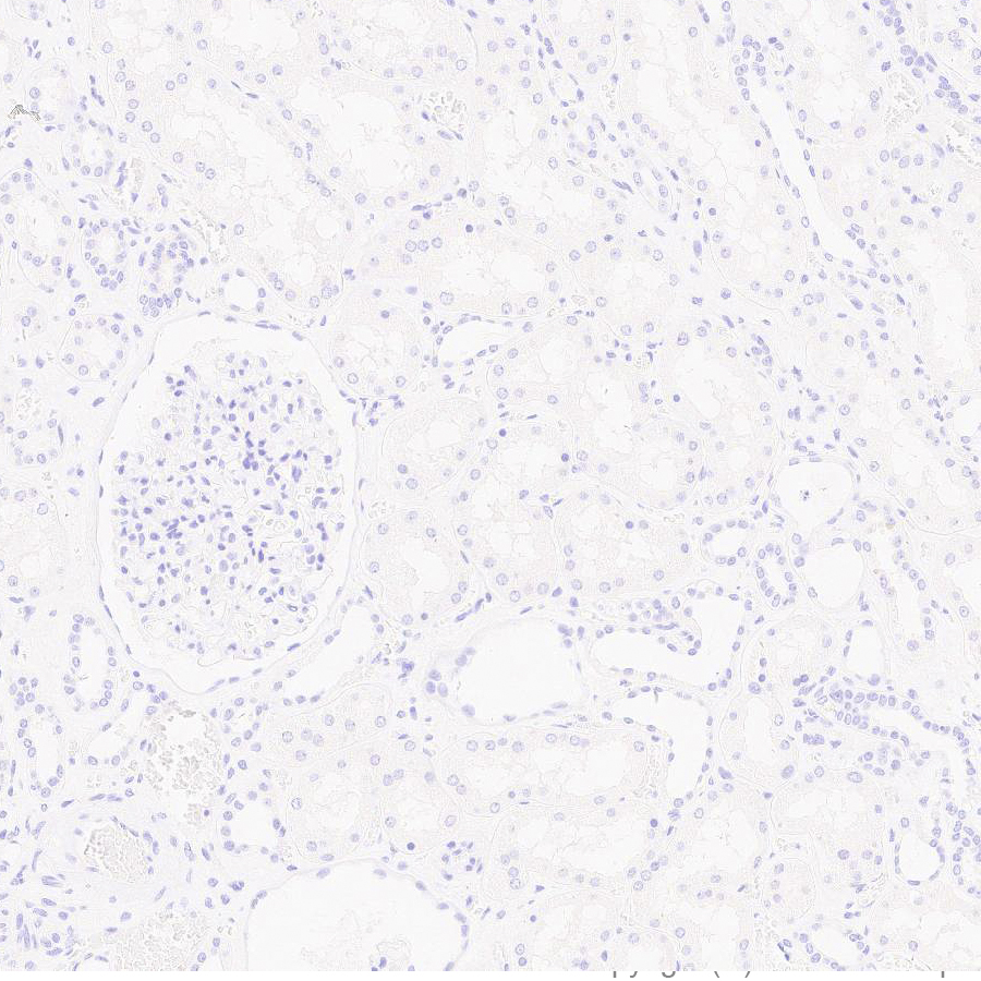 Immunohistochemistry (Formalin/PFA-fixed paraffin-embedded sections) - Anti-Uteroglobin antibody [EPR27144-86] - BSA and Azide free (AB307667), expandable thumbnail