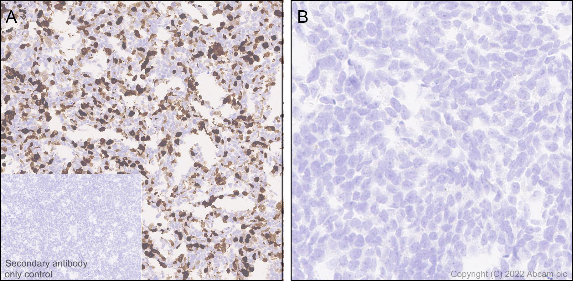Immunohistochemistry (Formalin/PFA-fixed paraffin-embedded sections) - Anti-Uteroglobin antibody [EPR27144-86] - BSA and Azide free (AB307667), expandable thumbnail