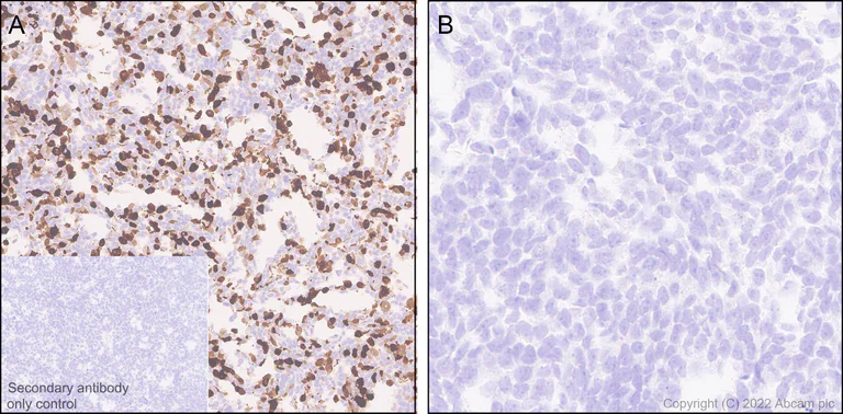 Immunohistochemistry (Formalin/PFA-fixed paraffin-embedded sections) - Anti-Uteroglobin antibody [EPR27144-86] - BSA and Azide free (AB307667)