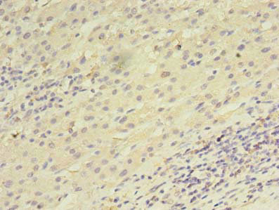 Immunohistochemistry (Formalin/PFA-fixed paraffin-embedded sections) - Anti-UTP23 antibody (AB235327)