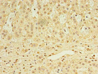 Immunohistochemistry (Formalin/PFA-fixed paraffin-embedded sections) - Anti-UTP23 antibody (AB235327)