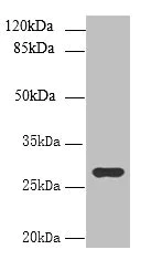 Western blot - Anti-UTP23 antibody (AB235327)