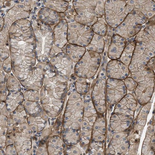 Immunohistochemistry (Formalin/PFA-fixed paraffin-embedded sections) - Anti-Utrophin antibody (AB244363), expandable thumbnail