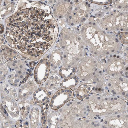 Immunohistochemistry (Formalin/PFA-fixed paraffin-embedded sections) - Anti-Utrophin antibody (AB244363), expandable thumbnail