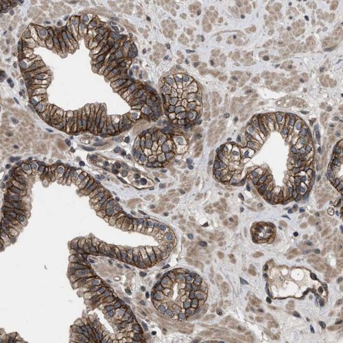 Immunohistochemistry (Formalin/PFA-fixed paraffin-embedded sections) - Anti-Utrophin antibody (AB244363), expandable thumbnail