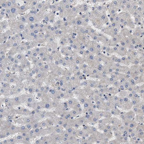 Immunohistochemistry (Formalin/PFA-fixed paraffin-embedded sections) - Anti-Utrophin antibody (AB244363), expandable thumbnail