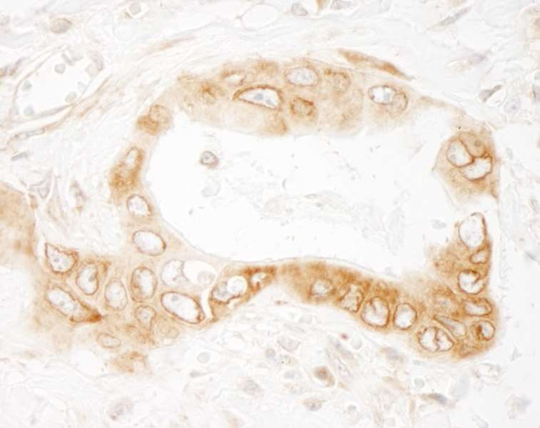 Immunohistochemistry (Formalin/PFA-fixed paraffin-embedded sections) - Anti-UVRAG antibody (AB264258), expandable thumbnail