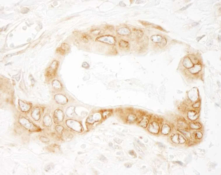 Immunohistochemistry (Formalin/PFA-fixed paraffin-embedded sections) - Anti-UVRAG antibody (AB264258)
