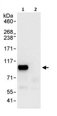 Immunoprecipitation - Anti-UVRAG antibody (AB264258), expandable thumbnail