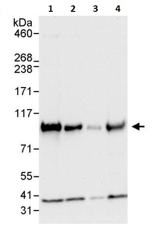 Western blot - Anti-UVRAG antibody (AB264258), expandable thumbnail