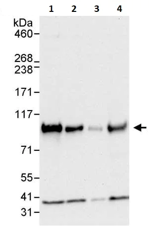 Western blot - Anti-UVRAG antibody (AB264258)
