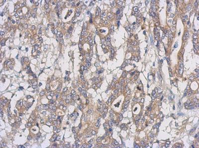 Immunohistochemistry (Formalin/PFA-fixed paraffin-embedded sections) - Anti-UXS-1 antibody (AB155226), expandable thumbnail