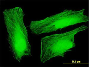 Immunocytochemistry/ Immunofluorescence - Anti-UXT antibody (AB168678)