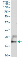 Western blot - Anti-UXT antibody (AB168678)