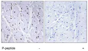 Immunohistochemistry (Formalin/PFA-fixed paraffin-embedded sections) - Anti-v-Myb + c-Myb (phospho S12) antibody (AB78892)