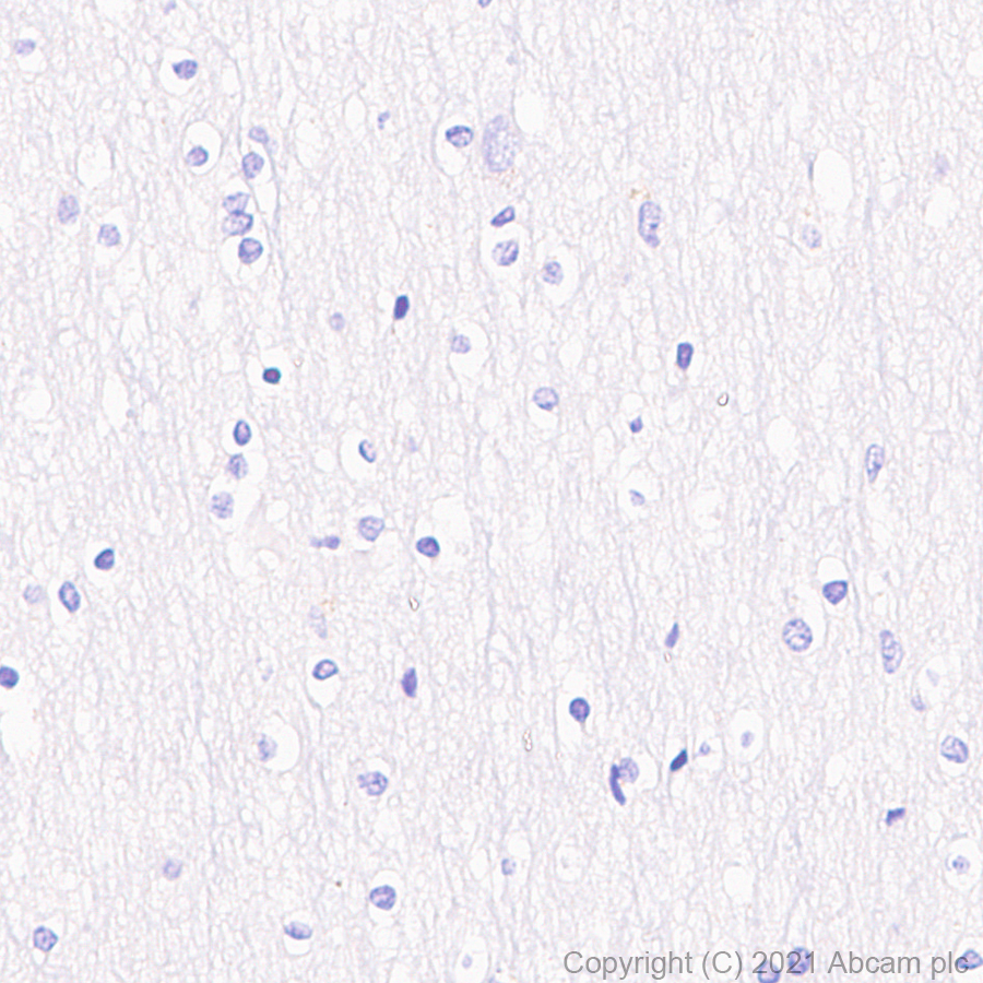 Immunohistochemistry (Formalin/PFA-fixed paraffin-embedded sections) - Anti-V2R antibody [EPR24555-59] (AB273021)