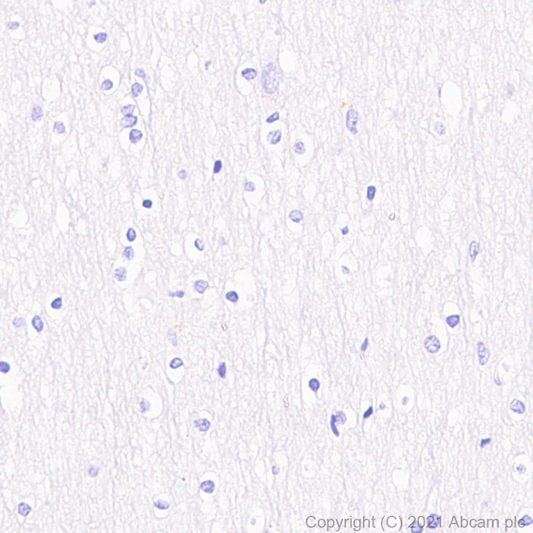 Immunohistochemistry (Formalin/PFA-fixed paraffin-embedded sections) - Anti-V2R antibody [EPR24555-59] (AB273021)