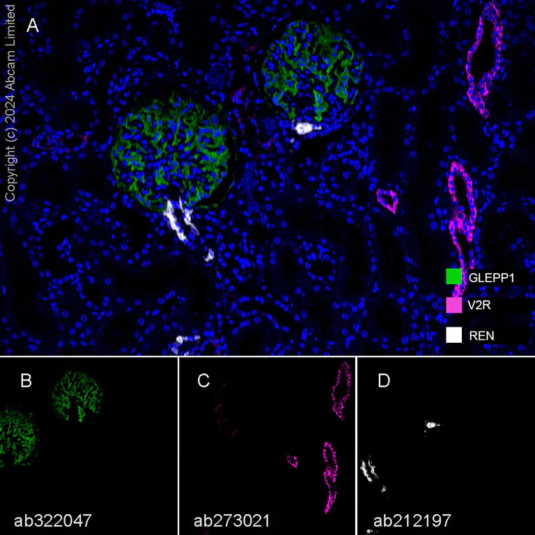 Multiplex immunohistochemistry - Anti-V2R antibody [EPR24555-59] - BSA and Azide free (AB282010)